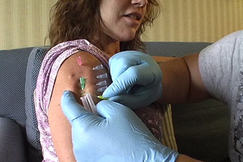 Needle Insertion Techniques